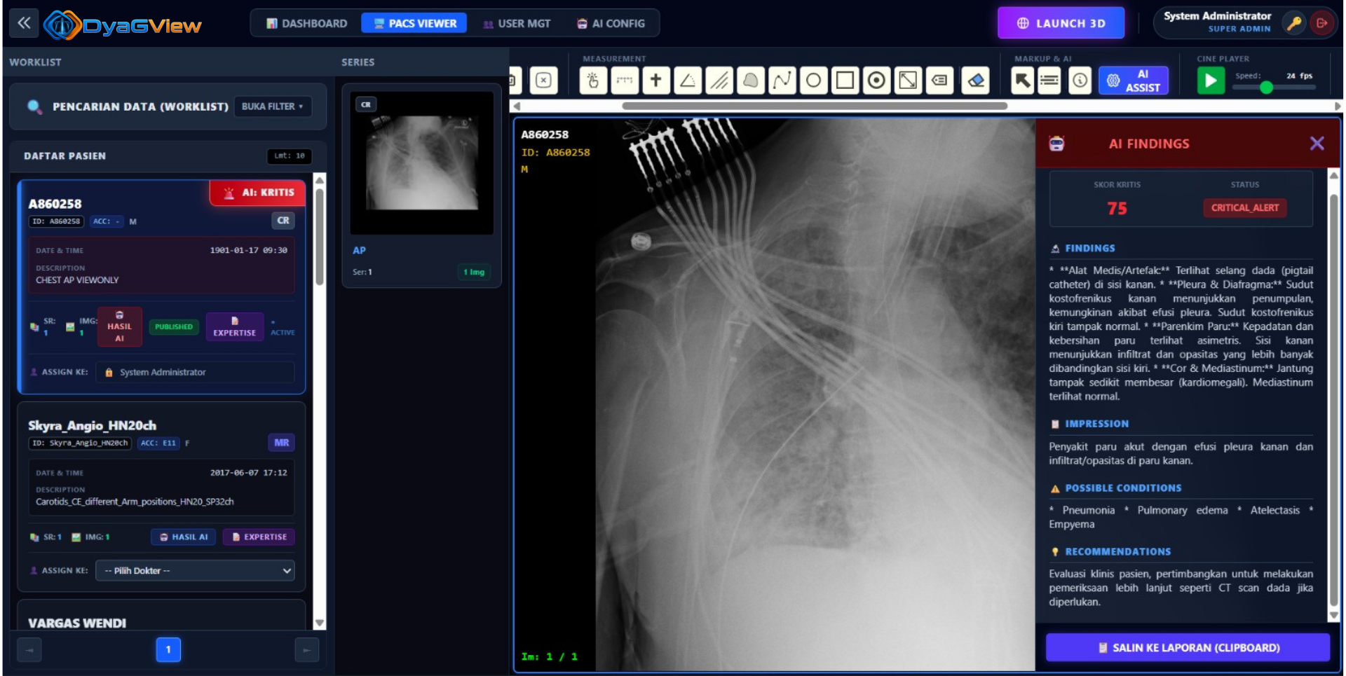 DyaGView 4
