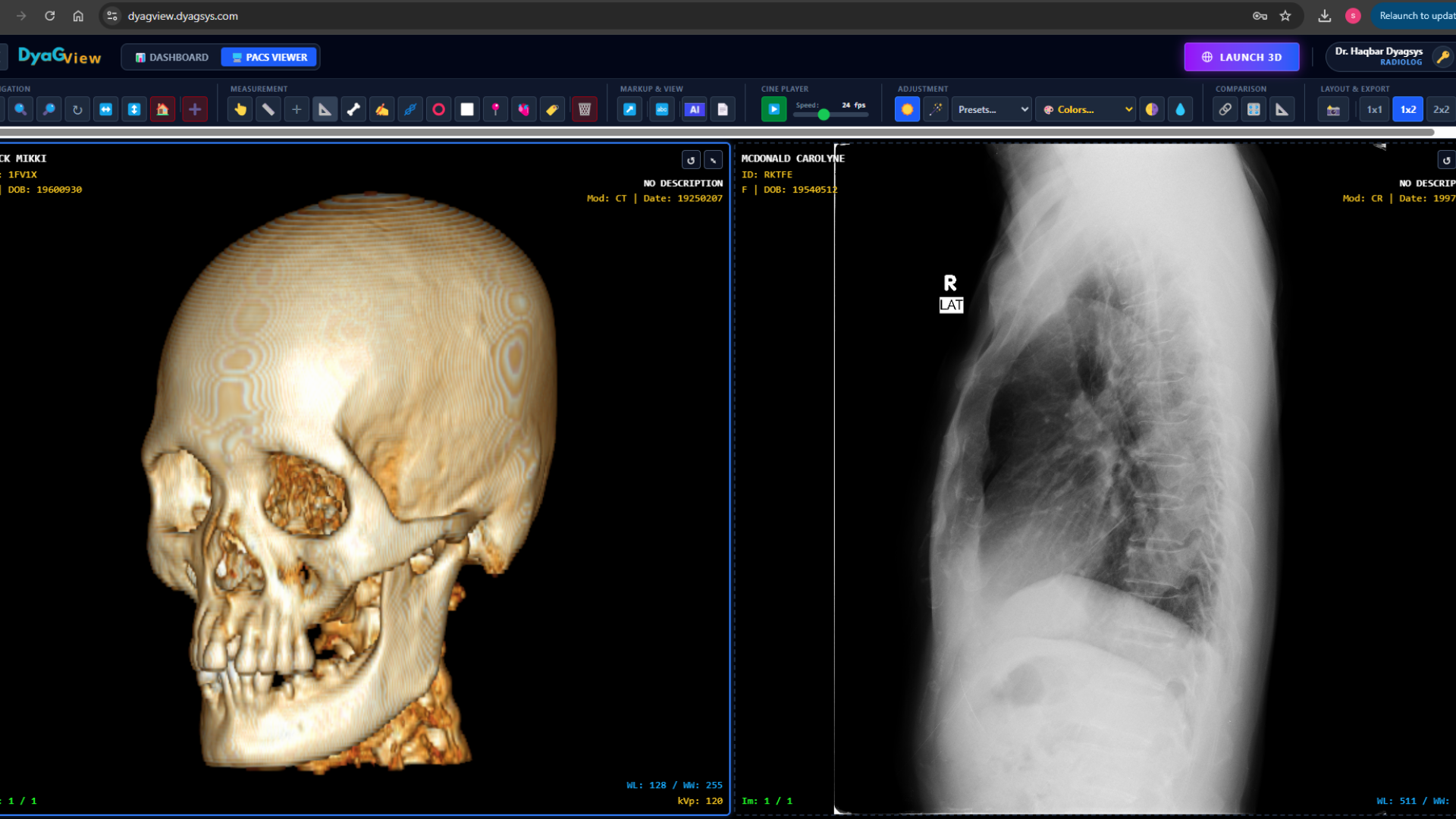 DyaGView Zero-Footprint DICOM viewer
